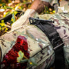 A representation of the TacMed SOF Tourniquet applied on a patient's leg.